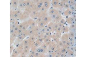 IHC-P analysis of Human Tissue, with DAB staining. (IGFBPI anticorps  (AA 159-249))