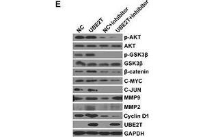 UBE2T promotes NPC cell proliferation and metastasis probably by activating the AKT/GSK3β/β-catenin pathwayA.