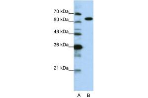 WB Suggested Anti-KARS Antibody Titration:  0. (KARS anticorps  (C-Term))