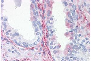 Human Prostate: Formalin-Fixed, Paraffin-Embedded (FFPE) (Aquaporin 8 anticorps  (AA 1-255))