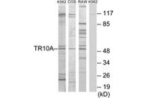 Western Blotting (WB) image for anti-Tumor Necrosis Factor Receptor Superfamily, Member 10a (TNFRSF10A) (AA 401-450) antibody (ABIN2889300)