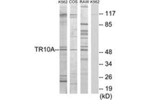 Western Blotting (WB) image for anti-Tumor Necrosis Factor Receptor Superfamily, Member 10a (TNFRSF10A) (AA 401-450) antibody (ABIN2889300) (TNFRSF10A anticorps  (AA 401-450))