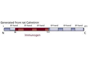 Image no. 3 for anti-Calbindin 2 (CALB2) (AA 38-151) antibody (ABIN968244) (Calretinin anticorps  (AA 38-151))