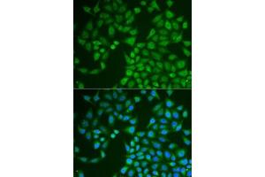 Immunofluorescence analysis of U2OS cells using PNLIP antibody (ABIN6128521, ABIN6145838, ABIN6145840 and ABIN6222025). (PNLIP anticorps  (AA 166-465))
