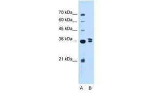 Image no. 1 for anti-Transcription Factor B1, Mitochondrial (TFB1M) (AA 151-200) antibody (ABIN324363) (TFB1M anticorps  (AA 151-200))