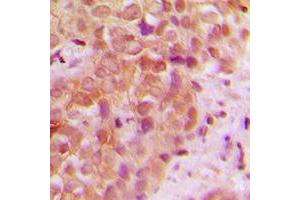 anti-Ubiquitin Protein Ligase E3 Component N-Recognin 5 (UBR5) (N-Term) antibody