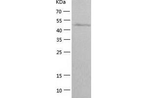 Western Blotting (WB) image for ERO1-Like Protein alpha (ERO1L) (AA 24-468) protein (His-IF2DI Tag) (ABIN7122815)