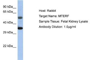 Host: Rabbit Target Name: MTERF1 Sample Tissue: Human Fetal Kidney Antibody Dilution: 1ug/ml (MTERF anticorps  (C-Term))