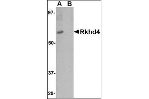 Western blot analysis of Rkhd4 in SK-N-SH cell lysate with this product at 1 μg/ml in (A) the absence and (B) the presence of blocking peptide. (MEX3A anticorps  (C-Term))