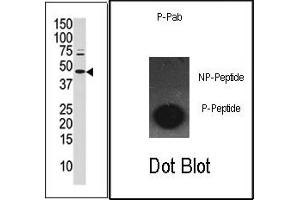 Image no. 1 for anti-Jun Proto-Oncogene (JUN) (pSer63) antibody (ABIN358111) (C-JUN anticorps  (pSer63))