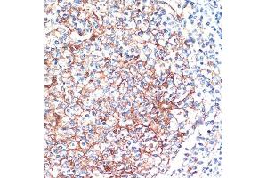 Immunohistochemistry of paraffin-embedded Human tonsil using 14-3-3 alpha/beta antibody (ABIN3021284, ABIN3021285, ABIN3021286 and ABIN6214397) at dilution of 1:200 (40x lens).