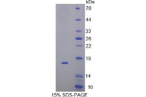 Image no. 1 for Cytochrome P450, Family 11, Subfamily A, Polypeptide 1 (CYP11A1) (AA 391-515) protein (His tag) (ABIN6238282)