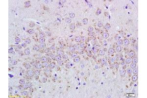 Formalin-fixed and paraffin embedded rat brain tissue labeled with Anti-cGMP Polyclonal Antibody, Unconjugated (ABIN750733) at 1:400, followed by conjugation to the secondary antibody and DAB staining (Cyclic GMP anticorps)