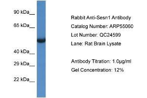 Western Blotting (WB) image for anti-Sestrin 1 (SESN1) (C-Term) antibody (ABIN2786033)