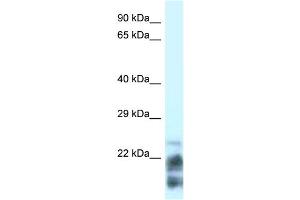 WB Suggested Anti-MDP-1 Antibody Titration: 0. (MDP1 anticorps  (N-Term))