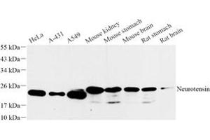 Western blot analysis of Neurotensin (ABIN7074827) at dilution of 1: 1000 (Neurotensin anticorps)