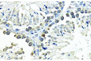 Immunohistochemistry of paraffin-embedded Mouse testis using SUMO1 Polyclonal Antibody at dilution of 1:200 (40x lens). (SUMO1 anticorps)