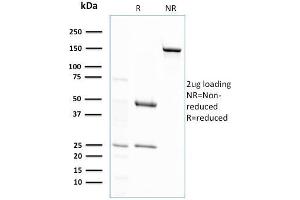 SDS-PAGE Analysis Purified GSTMu2 Mouse Monoclonal Antibody (CPTC-GSTMu2-2).