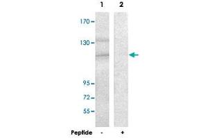 Western blot analysis of extracts from HUVEC cells, using SDCCAG1 polyclonal antibody . (NEMF anticorps)