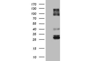 Western Blotting (WB) image for anti-Immunoglobulin Superfamily, Member 11 (IGSF11) (AA 23-241) antibody (ABIN2674600) (IGSF11 anticorps  (AA 23-241))