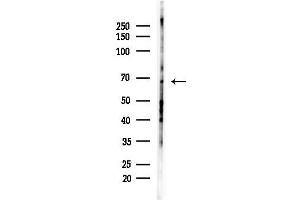 anti-G Protein-Coupled Receptor Kinase 5 (GRK5) (Internal Region) antibody