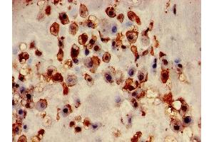 Immunohistochemistry of paraffin-embedded human placenta tissue using ABIN7153453 at dilution of 1:100 (Galectin 3 anticorps  (AA 2-250))