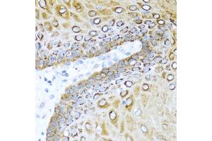 Immunohistochemistry of paraffin-embedded human esophagus using S100A7 antibody. (S100A7 anticorps)