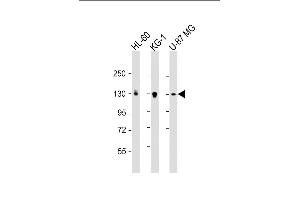 All lanes : Anti-DEPD5 Antibody (C-term) at 1:2000 dilution Lane 1: HL-60 whole cell lysate Lane 2: KG-1 whole cell lysate Lane 3: U-87 MG whole cell lysate Lysates/proteins at 20 μg per lane. (DEPDC5 anticorps  (AA 1404-1432))