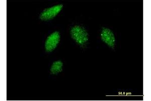 anti-Cyclin G1 (CCNG1) (AA 1-295) antibody