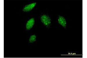 Immunofluorescence of purified MaxPab antibody to CCNG1 on HeLa cell. (Cyclin G1 anticorps  (AA 1-295))