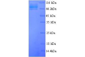 SDS-PAGE (SDS) image for Glucokinase (Hexokinase 4) Regulator (GCKR) (AA 1-625), (full length) protein (His tag) (ABIN5714340)
