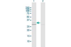 Western Blot analysis of SIRT5 expression in transfected 293T cell line by SIRT5 MaxPab polyclonal antibody. (SIRT5 anticorps  (AA 1-310))