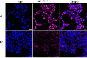 Immunocytochemical staining of HeLa cells using NDUFB10 antibody (ABIN7799547), 1:1,000), Top panel: wild-type (WT), Bottom panal: NDUFB10 shRNA knockdown (KD).