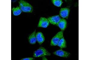 IF analysis of ITCH/AIP4 using anti-ITCH/AIP4 antibody (ABIN7600264).