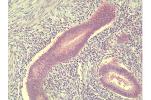 Anti-TSN / Translin antibody IHC staining of human uterus, endometrium.
