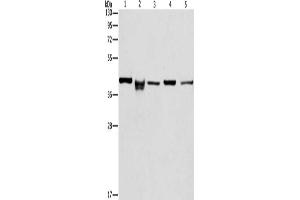 Gel: 10 % SDS-PAGE, Lysate: 40 μg, Lane 1-5: HepG2 cells, mouse kidney tissue, lovo cells, mouse eyes tissue, hela cells, Primary antibody: ABIN7129804(IDH3B Antibody) at dilution 1/233. (IDH3B anticorps)