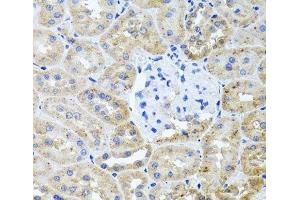 Immunohistochemistry of paraffin-embedded Rat kidney using HDAC6 Polyclonal Antibody at dilution of 1:100 (40x lens). (HDAC6 anticorps)