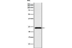 Western blot analysis of Mad2L2 expression in Hela cell lysate.