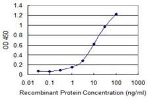 Detection limit for recombinant GST tagged SCML2 is 0.