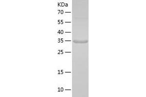 Western Blotting (WB) image for Oligodendrocyte Lineage Transcription Factor 2 (OLIG2) (AA 1-323) protein (His-IF2DI Tag) (ABIN7124257)