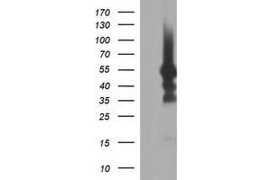 Image no. 1 for anti-Tubulin, beta 1 (TUBB1) antibody (ABIN1501569)