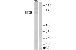 Western blot analysis of extracts from K562 cells, using SIX5 antibody. (Six5 anticorps  (Internal Region))