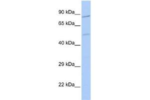 WB Suggested Anti-ZNF585B Antibody Titration:  0. (ZNF585B anticorps  (N-Term))