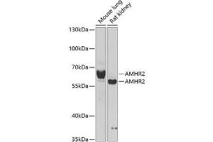 Western blot analysis of extracts of various cell lines using AMHR2 Polyclonal Antibody at dilution of 1:1000. (AMHR2 anticorps)