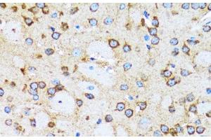 Immunohistochemistry of paraffin-embedded Rat brain using ACTR2 Polyclonal Antibody at dilution of 1:100 (40x lens). (ACTR2 anticorps)
