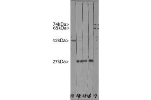Western blots of HeLa cell crude extracts.