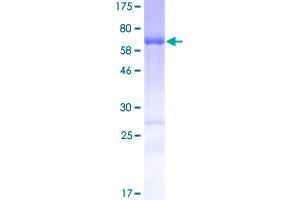 Image no. 1 for SH3 and Cysteine Rich Domain (STAC) (AA 1-402) protein (GST tag) (ABIN1321537)