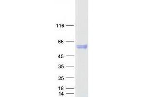 Validation with Western Blot