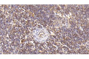 Detection of IL6 in Human Spleen Tissue using Monoclonal Antibody to Interleukin 6 (IL6) (IL-6 anticorps  (AA 30-212))