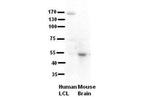 WB Suggested Anti-RRP1 Antibody Titration:  5% Milk  ELISA Titer:  dilution: 1:500  Positive Control:  human LCL and mouse brains (RRP1 anticorps  (C-Term))